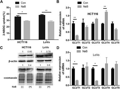 Butyrate Suppresses Glucose Metabolism of Colorectal Cancer Cells via GPR109a-AKT Signaling Pathway and Enhances Chemotherapy